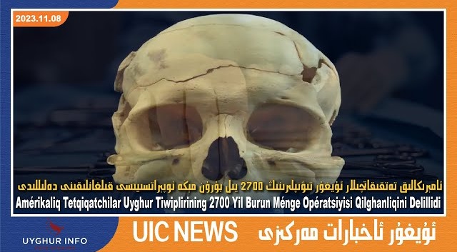 ئامېرىكالىق تەتقىقاتچىلار ئۇيغۇر تىۋىپلىرىنىڭ 2700 يىل بۇرۇن مېڭە ئوپېراتسىيىسى قىلغانلىقىنى دەلىللىدى